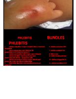 Bundles Plebitis