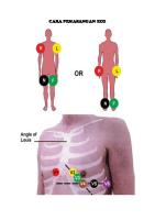 Cara Pemasangan Ecg