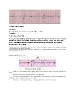 Gambaran Ekg VES Trigemini