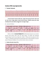 Gambaran EKG Yang Megancam Jiwa