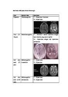 Gambaran MRI Pada Stroke Hemoragik