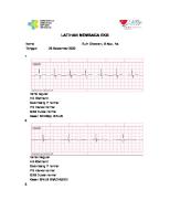 Latihan Membaca Ekg [PDF]