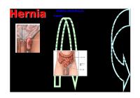 Leaflet Hernia [PDF]