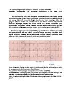 Left Ventricular Hypertrophy