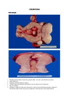 Leiomyoma & Leiomyosarcoma