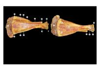 LKP Osteologi 2 Appendicular Skeleton