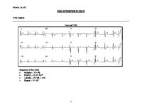 Membaca Ekg Untuk Pemula