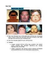 Moon Face, Face Swelling, Dan Plethoric Face