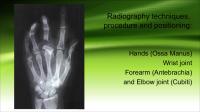 Radiography Techniques of Hands, Wrist Joint, Forearm and Elbow Joint